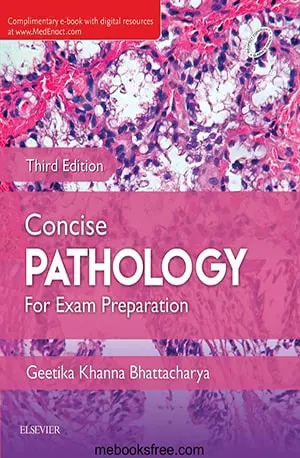 Concise Pathology For Exam Preparation - Geetika Khanna Bhattacharya - www.indianpdf.com_ - Download Book Novel PDF Online Free
